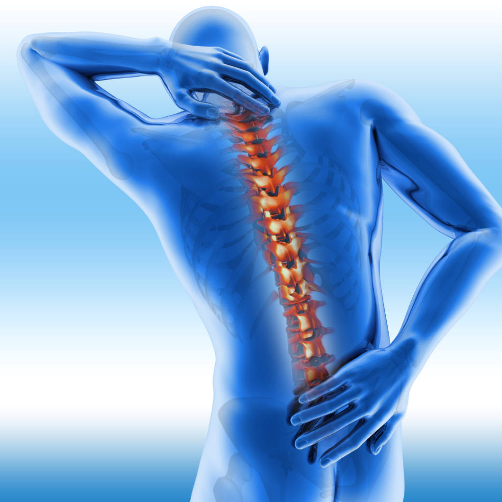 ELDOA for back pain and posture